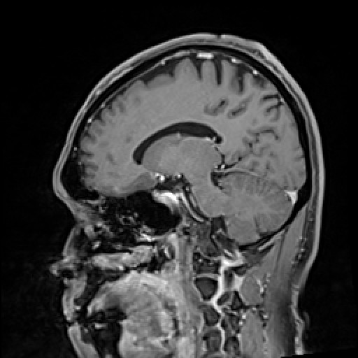 Click on the Serie image to view the images of VILLANUEVA, WILLIAM A.